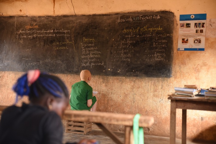 Afrikas weiße Außenseiter / Welttag des Albinismus: Die CBM fordert Aufklärung und Chancengleichheit