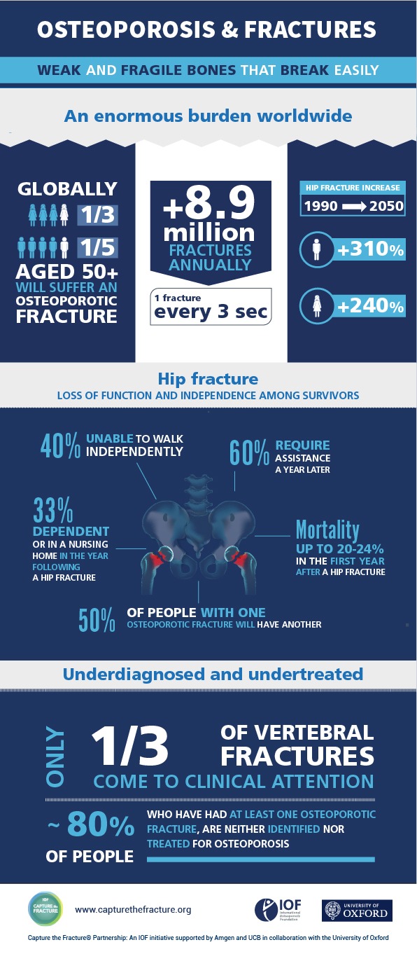 Neue Partnerschaft "Capture The Fracture"® setzt sich das Ziel, die Zahl der Hüftfrakturen und Wirbelbrüche durch Osteoporose bis 2025 um 25% zu reduzieren